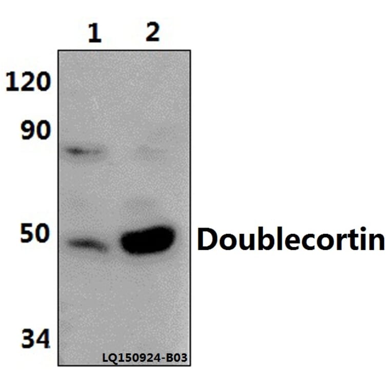 Anti-Doublecortin (K292) Antibody from Bioworld Technology (BS1635) - Antibodies.com