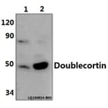 Anti-Doublecortin (K292) Antibody from Bioworld Technology (BS1635) - Antibodies.com