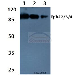 Anti-EphA2/3/4 (T587) Antibody from Bioworld Technology (BS1638) - Antibodies.com