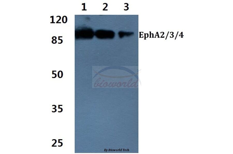Anti-EphA2/3/4 (T587) Antibody from Bioworld Technology (BS1638) - Antibodies.com