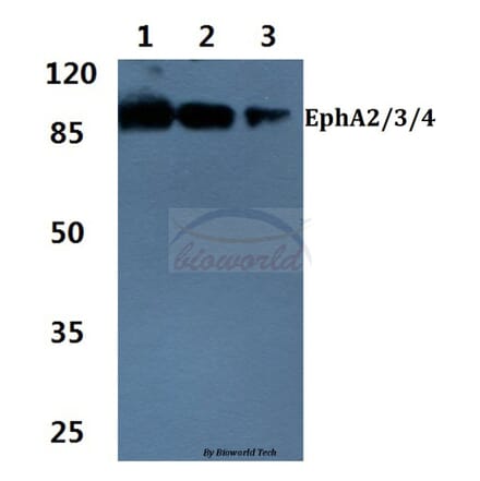 Anti-EphA2/3/4 (T587) Antibody from Bioworld Technology (BS1638) - Antibodies.com