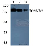 Anti-EphA2/3/4 (T587) Antibody from Bioworld Technology (BS1638) - Antibodies.com