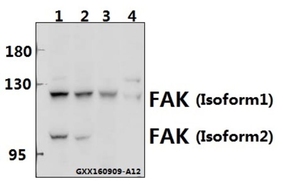 Anti-FAK (I401) Antibody from Bioworld Technology (BS1641) - Antibodies.com