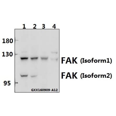 Anti-FAK (I401) Antibody from Bioworld Technology (BS1641) - Antibodies.com