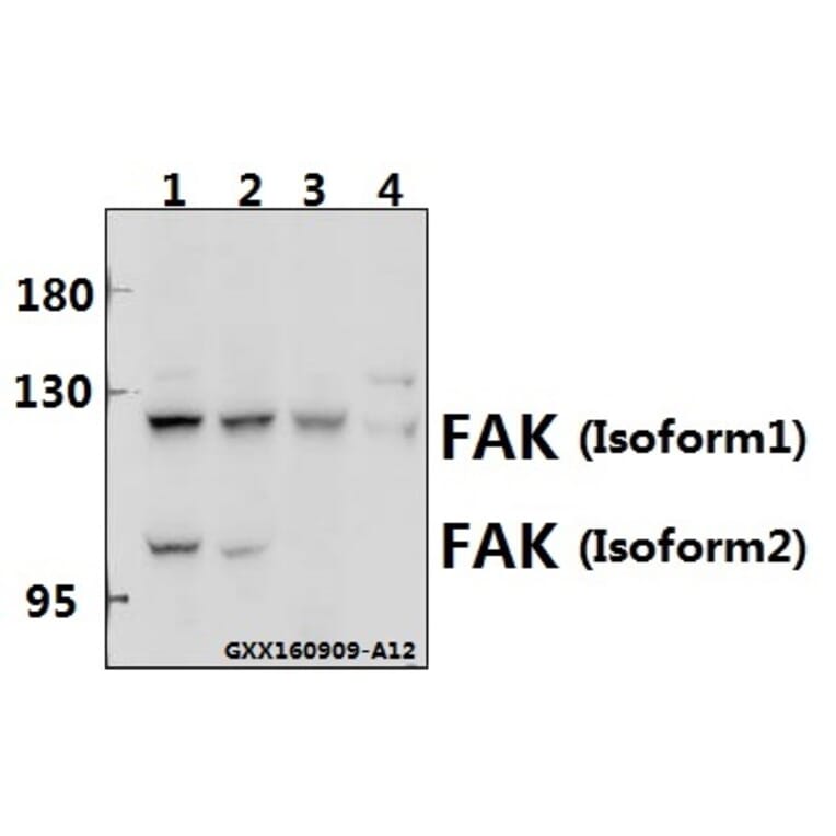 Anti-FAK (I401) Antibody from Bioworld Technology (BS1641) - Antibodies.com