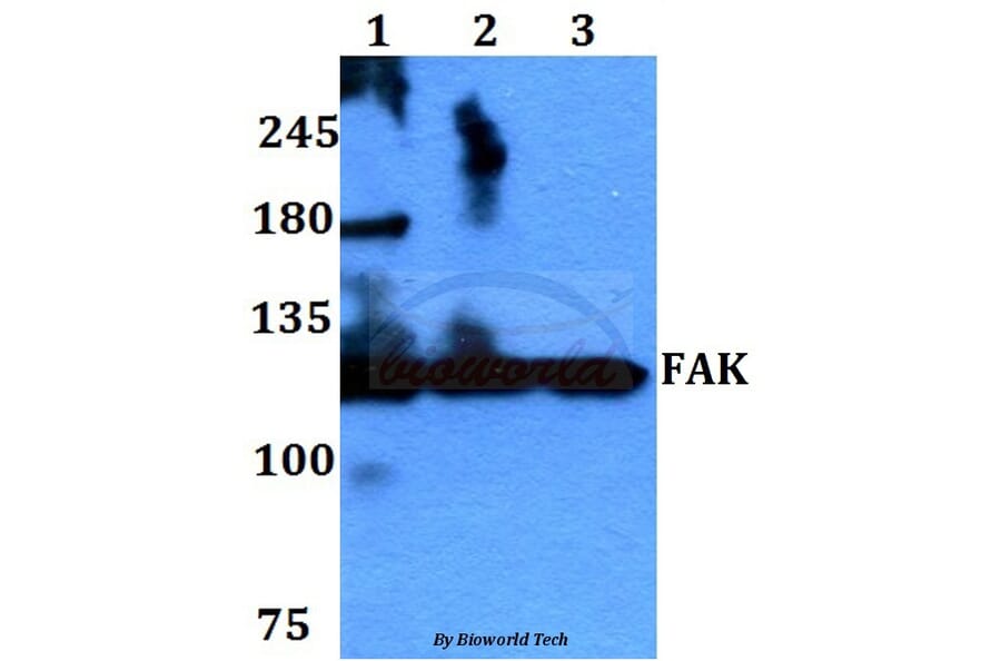Anti-FAK (I401) Antibody from Bioworld Technology (BS1641) - Antibodies.com