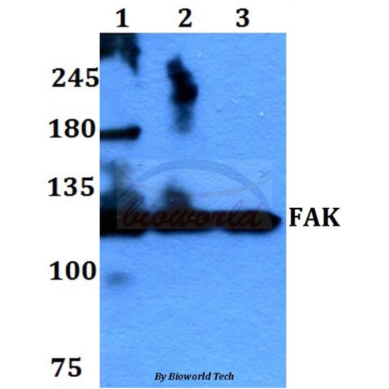 Anti-FAK (I401) Antibody from Bioworld Technology (BS1641) - Antibodies.com