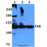 Anti-FAK (I401) Antibody from Bioworld Technology (BS1641) - Antibodies.com