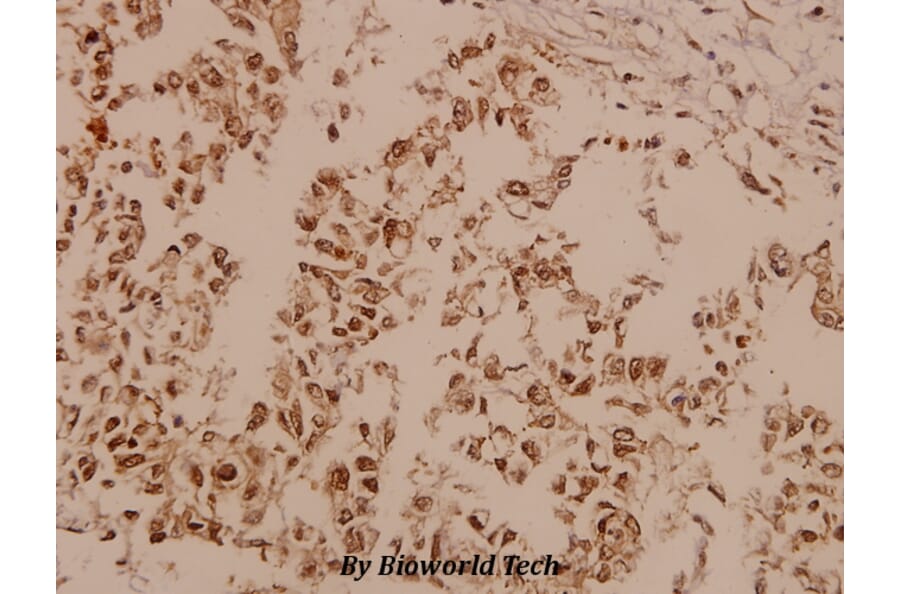 Anti-FAK (I401) Antibody from Bioworld Technology (BS1641) - Antibodies.com