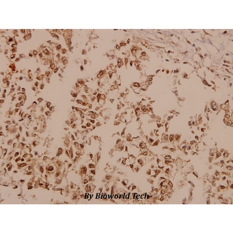 Anti-FAK (I401) Antibody from Bioworld Technology (BS1641) - Antibodies.com