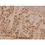 Anti-FAK (I401) Antibody from Bioworld Technology (BS1641) - Antibodies.com