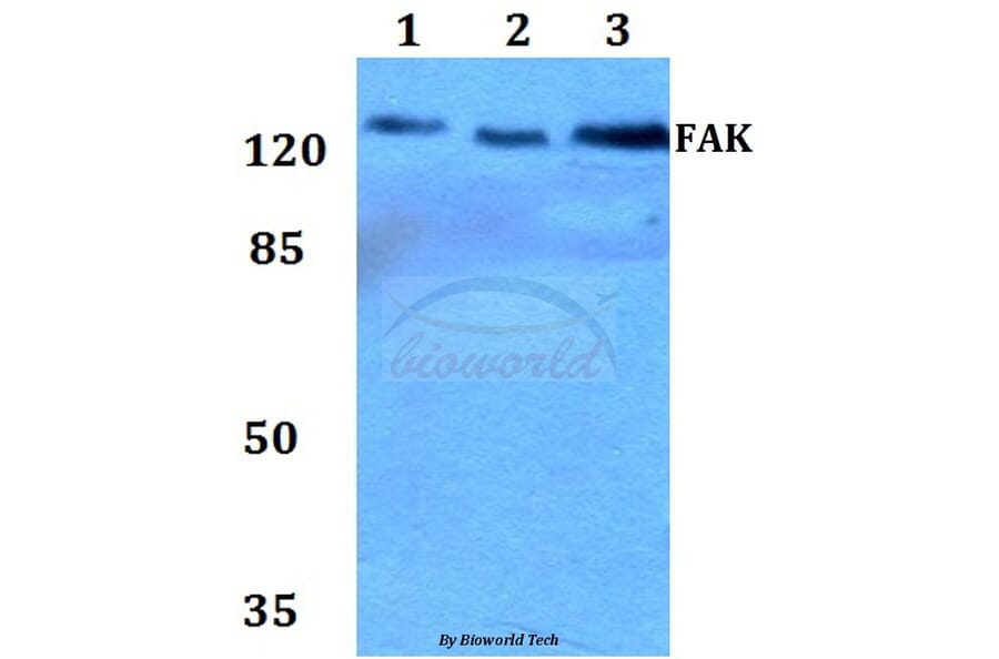 Anti-FAK (P906) Antibody from Bioworld Technology (BS1642) - Antibodies.com