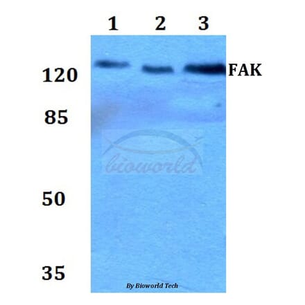 Anti-FAK (P906) Antibody from Bioworld Technology (BS1642) - Antibodies.com