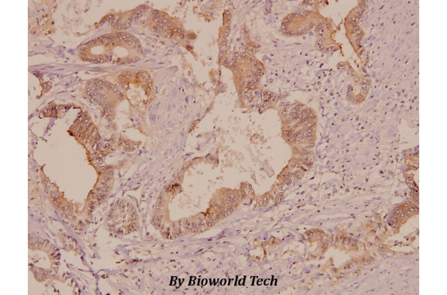 Anti-FAK (P906) Antibody from Bioworld Technology (BS1642) - Antibodies.com