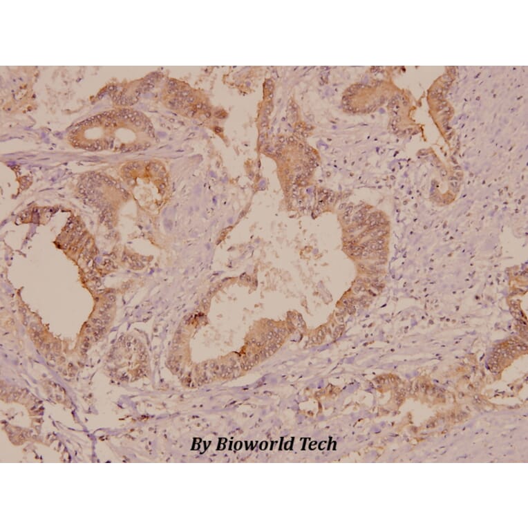Anti-FAK (P906) Antibody from Bioworld Technology (BS1642) - Antibodies.com