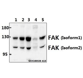 Anti-FAK (Y570) Antibody from Bioworld Technology (BS1643) - Antibodies.com