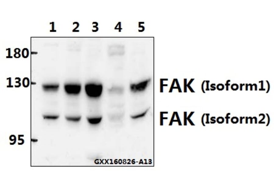 Anti-FAK (Y570) Antibody from Bioworld Technology (BS1643) - Antibodies.com