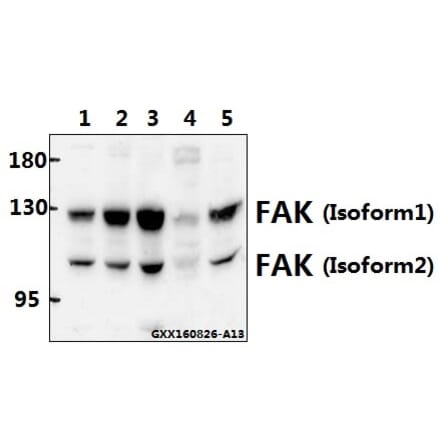 Anti-FAK (Y570) Antibody from Bioworld Technology (BS1643) - Antibodies.com