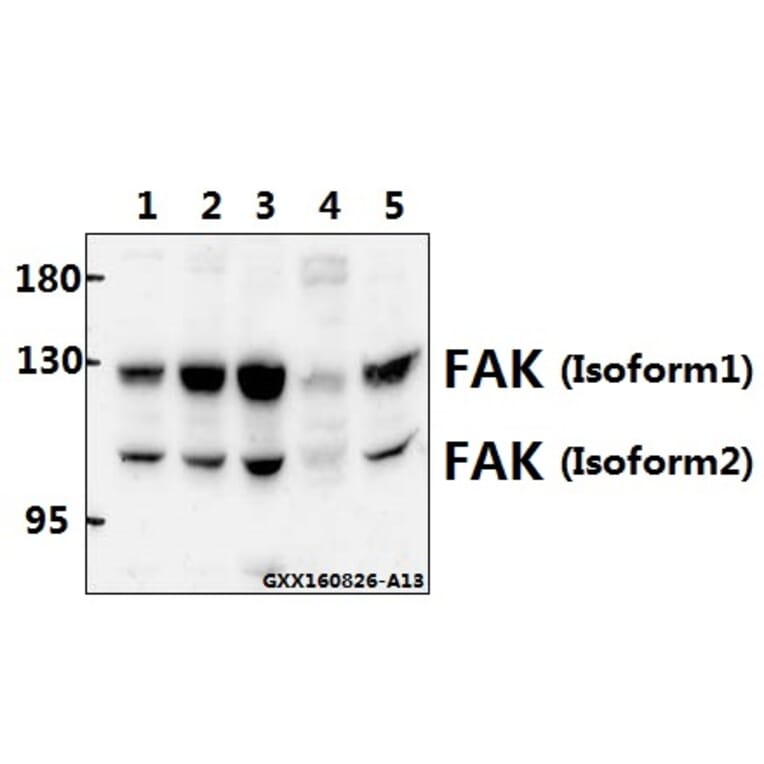 Anti-FAK (Y570) Antibody from Bioworld Technology (BS1643) - Antibodies.com