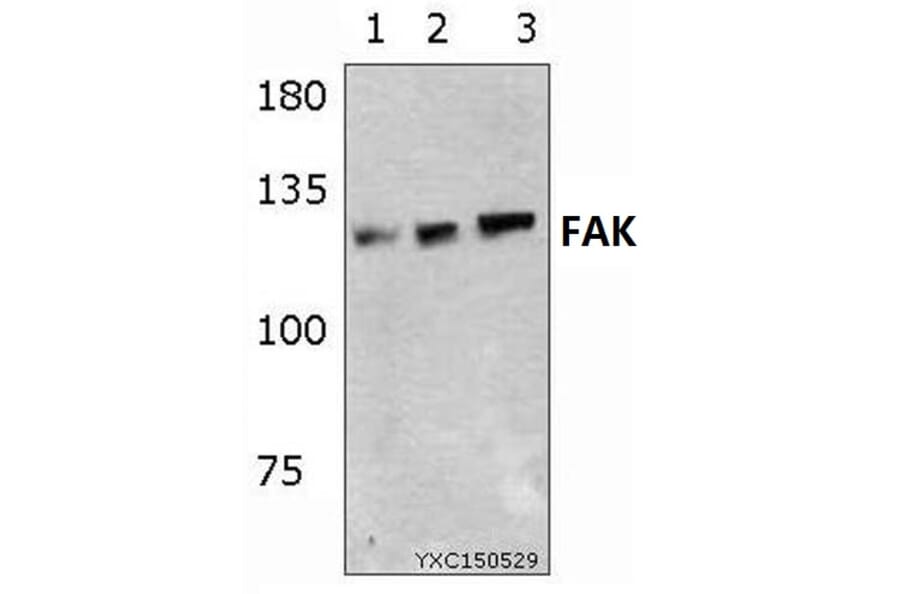 Anti-FAK (Y570) Antibody from Bioworld Technology (BS1643) - Antibodies.com