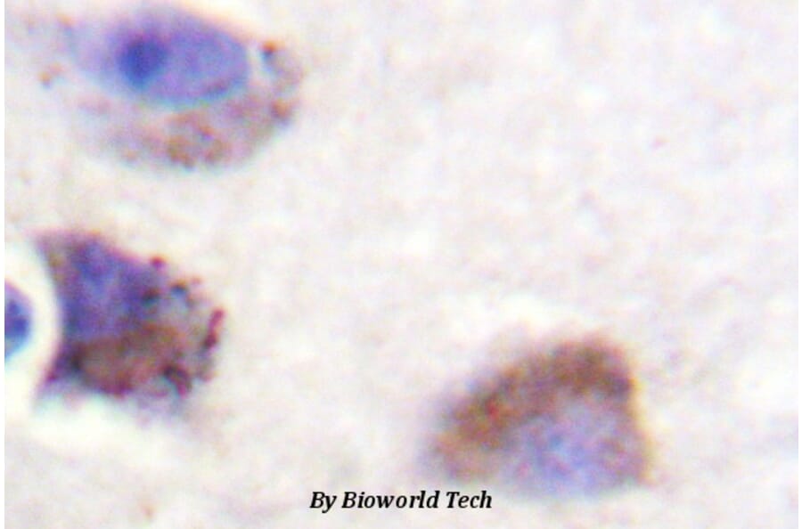 Anti-FAK (Y570) Antibody from Bioworld Technology (BS1643) - Antibodies.com
