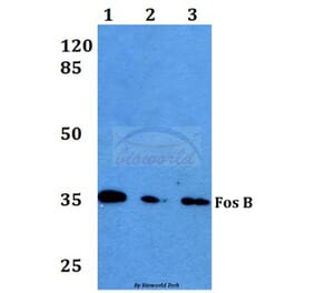 Anti-Fos B (S23) Antibody from Bioworld Technology (BS1645) - Antibodies.com