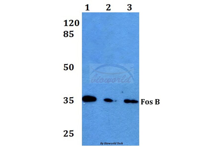 Anti-Fos B (S23) Antibody from Bioworld Technology (BS1645) - Antibodies.com