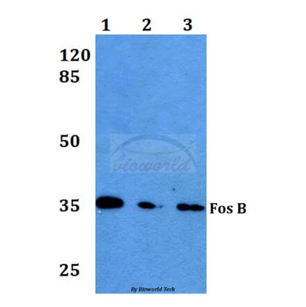 Anti-Fos B (S23) Antibody from Bioworld Technology (BS1645) - Antibodies.com