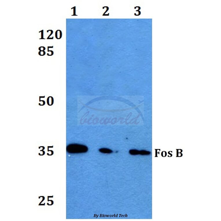 Anti-Fos B (S23) Antibody from Bioworld Technology (BS1645) - Antibodies.com