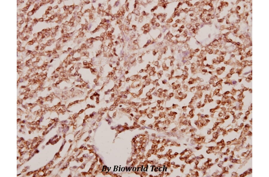 Anti-GATA2/3 (K304) Antibody from Bioworld Technology (BS1646) - Antibodies.com