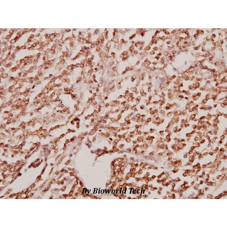 Anti-GATA2/3 (K304) Antibody from Bioworld Technology (BS1646) - Antibodies.com