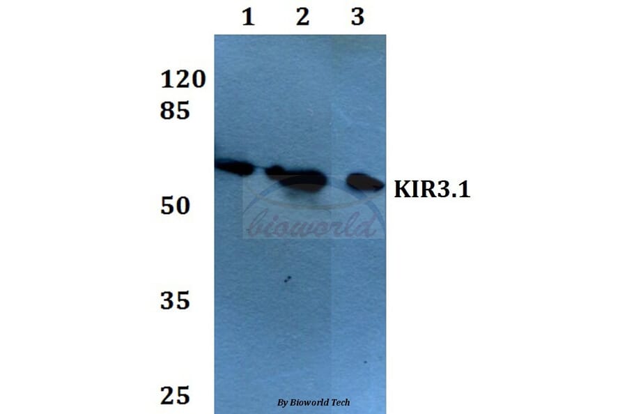 Anti-KIR3.1 (F181) Antibody from Bioworld Technology (BS1648) - Antibodies.com