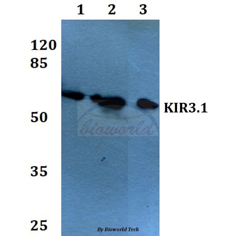 Anti-KIR3.1 (F181) Antibody from Bioworld Technology (BS1648) - Antibodies.com