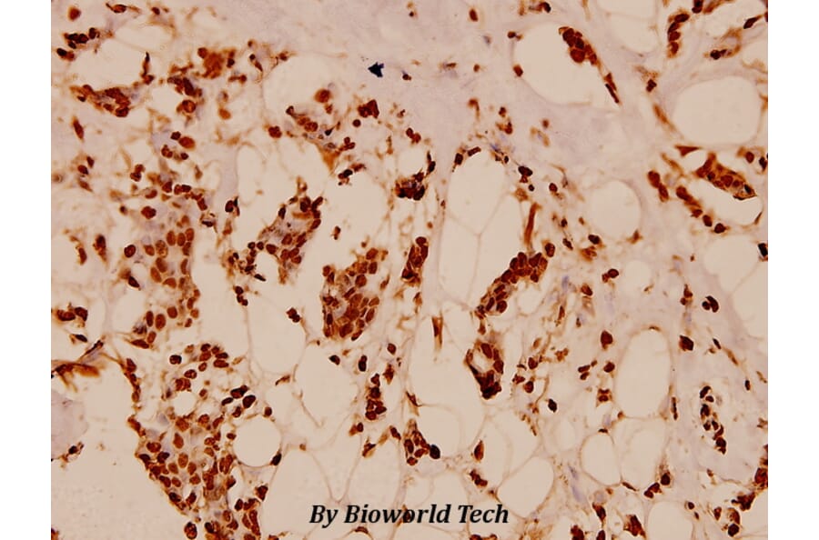 Anti-Histone H2B (K5) Antibody from Bioworld Technology (BS1657) - Antibodies.com