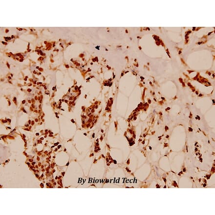 Anti-Histone H2B (K5) Antibody from Bioworld Technology (BS1657) - Antibodies.com