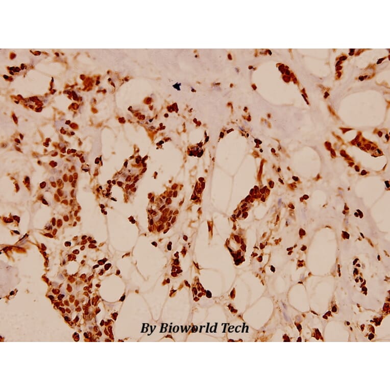 Anti-Histone H2B (K5) Antibody from Bioworld Technology (BS1657) - Antibodies.com