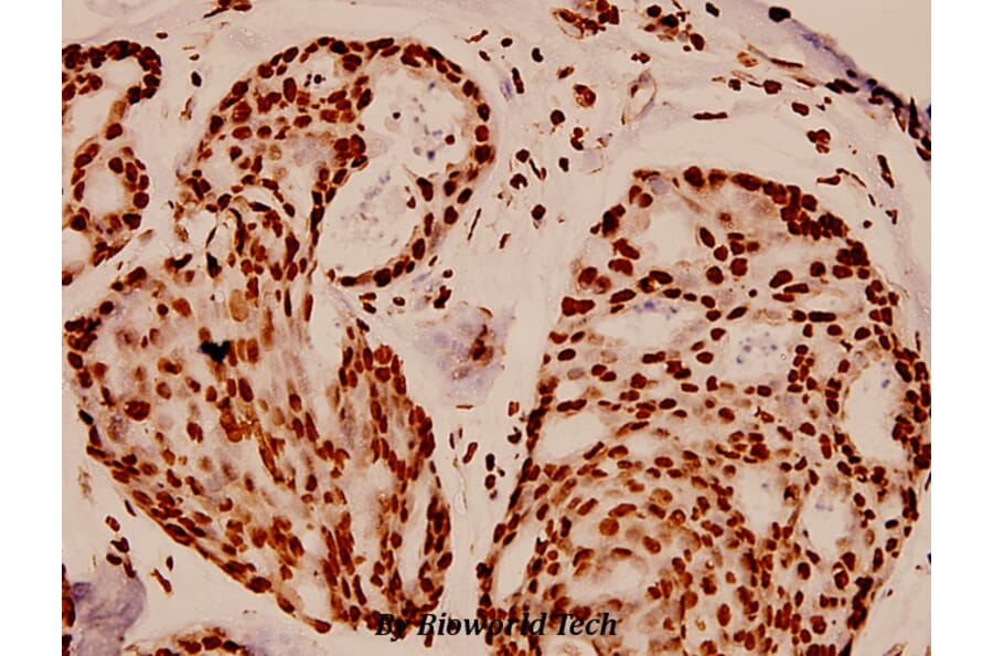 Anti-Histone H4 (K5) Antibody from Bioworld Technology (BS1662) - Antibodies.com