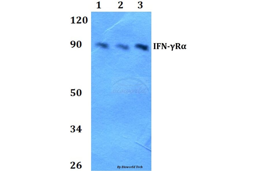 Anti-IFN-γRα (G456) Antibody from Bioworld Technology (BS1667) - Antibodies.com