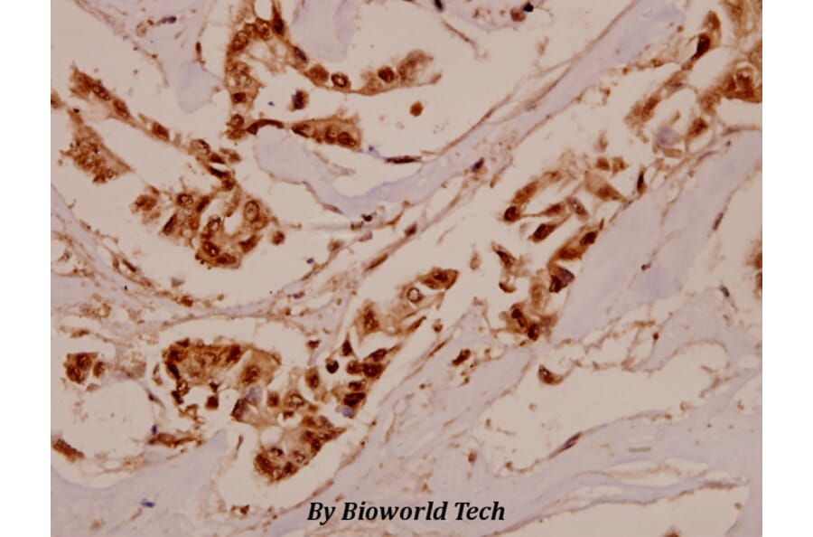 Anti-IFN-γRα (G456) Antibody from Bioworld Technology (BS1667) - Antibodies.com
