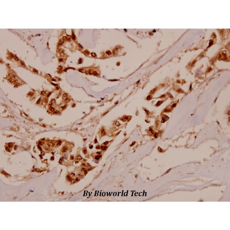 Anti-IFN-γRα (G456) Antibody from Bioworld Technology (BS1667) - Antibodies.com
