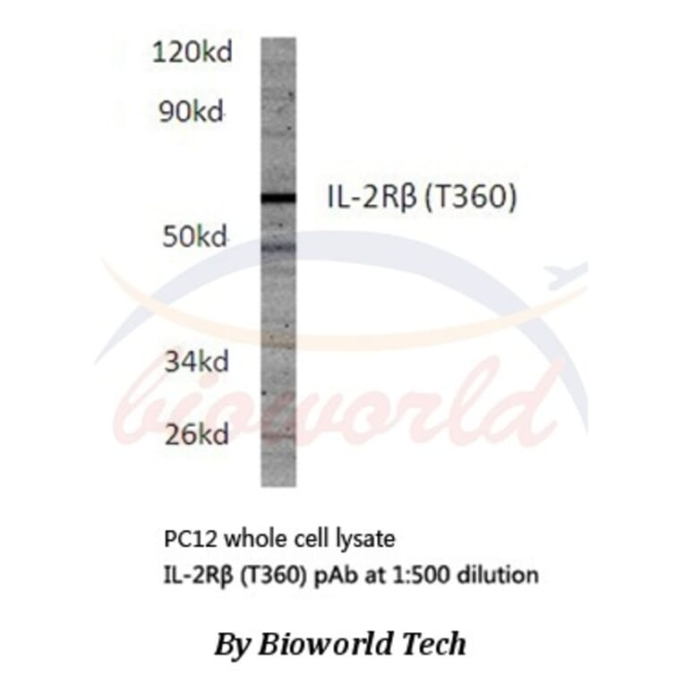 Anti-IL-2Rβ (T360) Antibody from Bioworld Technology (BS1668) - Antibodies.com