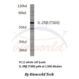 Anti-IL-2Rβ (T360) Antibody from Bioworld Technology (BS1668) - Antibodies.com