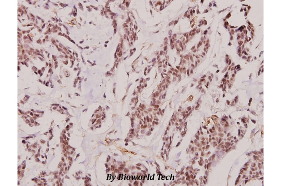Anti-IL-2Rβ (T360) Antibody from Bioworld Technology (BS1668) - Antibodies.com