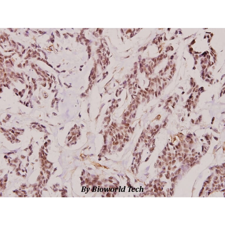 Anti-IL-2Rβ (T360) Antibody from Bioworld Technology (BS1668) - Antibodies.com