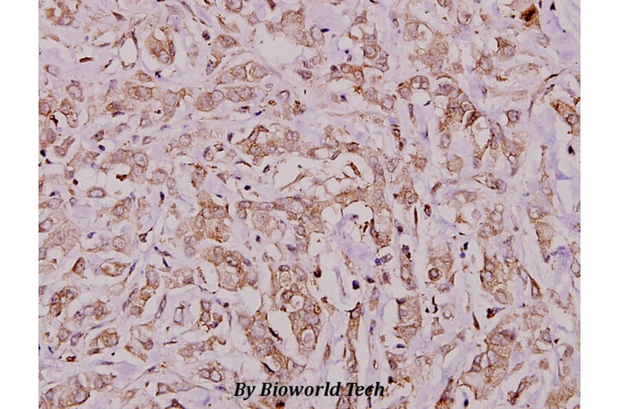 Anti-IRP-1 (R134) Antibody from Bioworld Technology (BS1670) - Antibodies.com