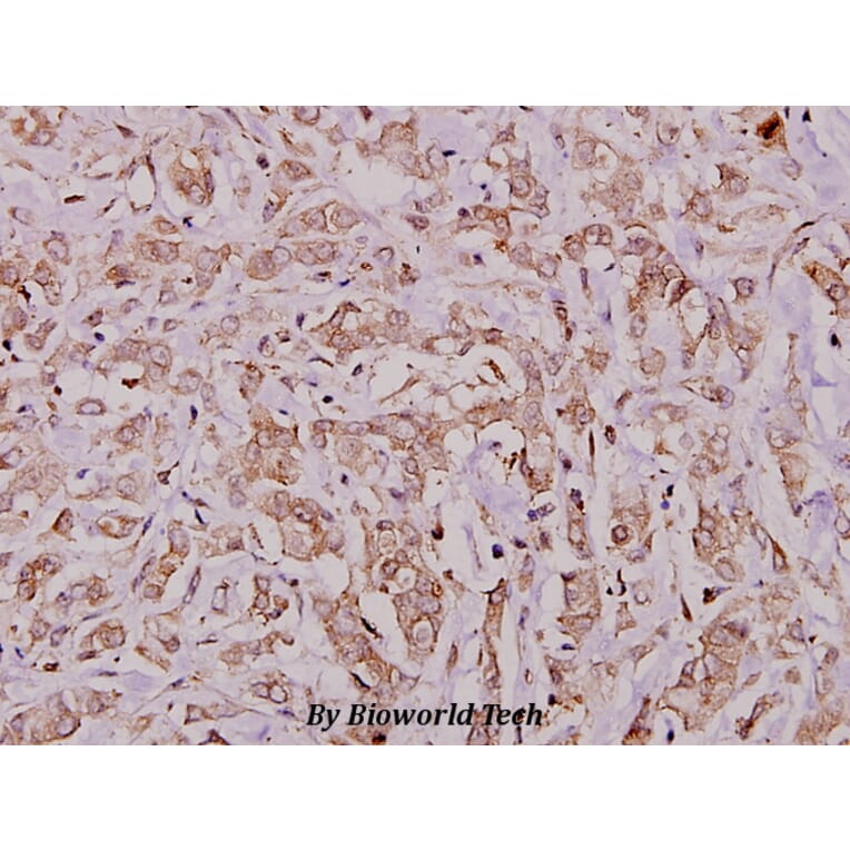Anti-IRP-1 (R134) Antibody from Bioworld Technology (BS1670) - Antibodies.com