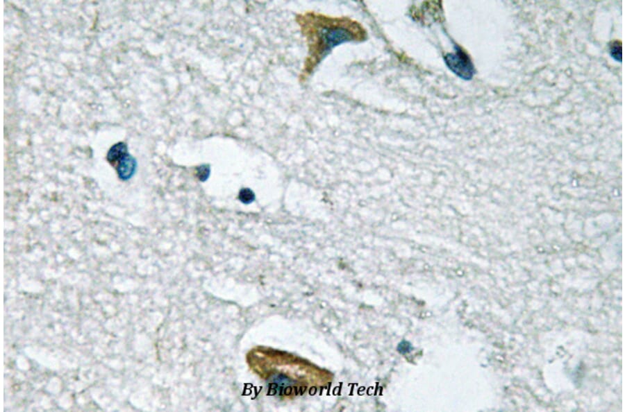 Anti-JAK3 (I781) Antibody from Bioworld Technology (BS1671) - Antibodies.com