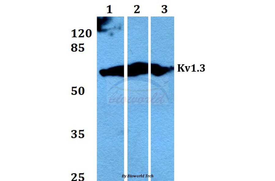 Anti-Kv1.3 (E131) Antibody from Bioworld Technology (BS1673) - Antibodies.com