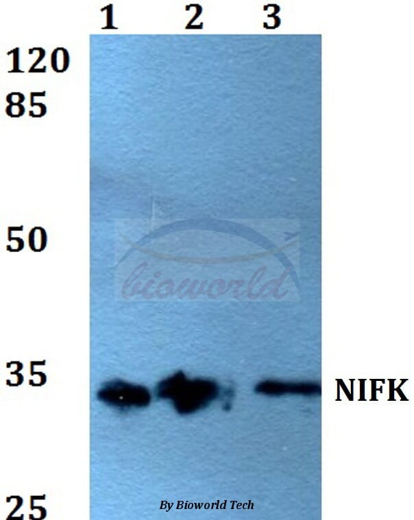 Anti-NIFK (D229) Antibody (A25701) | Antibodies.com