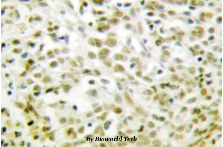 Anti-p53 (T310) Antibody from Bioworld Technology (BS1682) - Antibodies.com